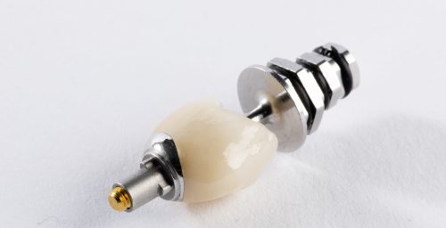 Crowns-screw-cement-scaled