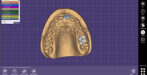 implant-workflow
