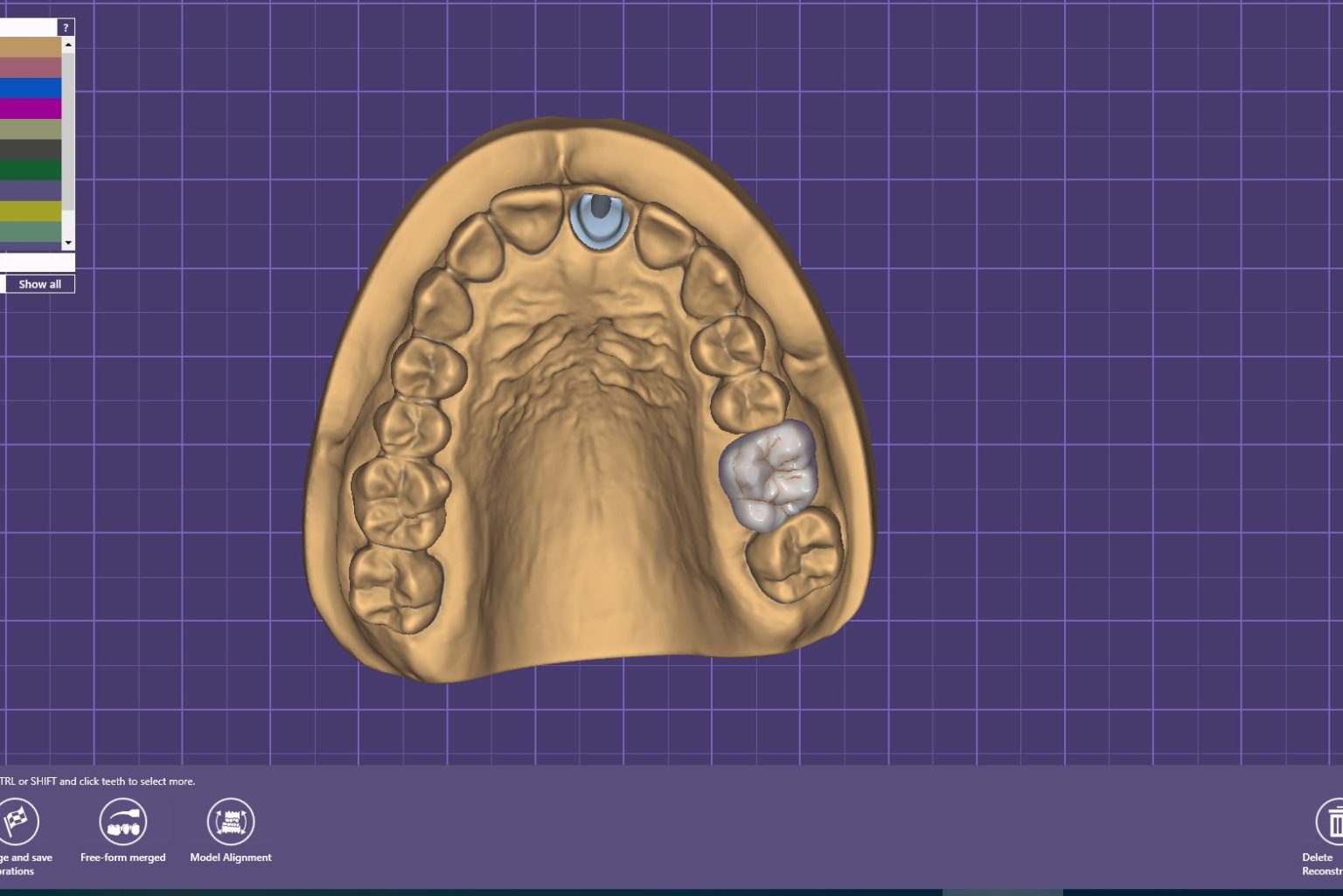 implant-workflow
