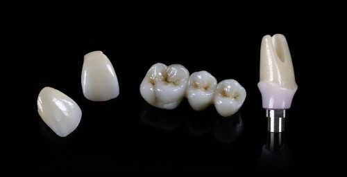 zirconia-and-metal-free-implant-prosthetic-options